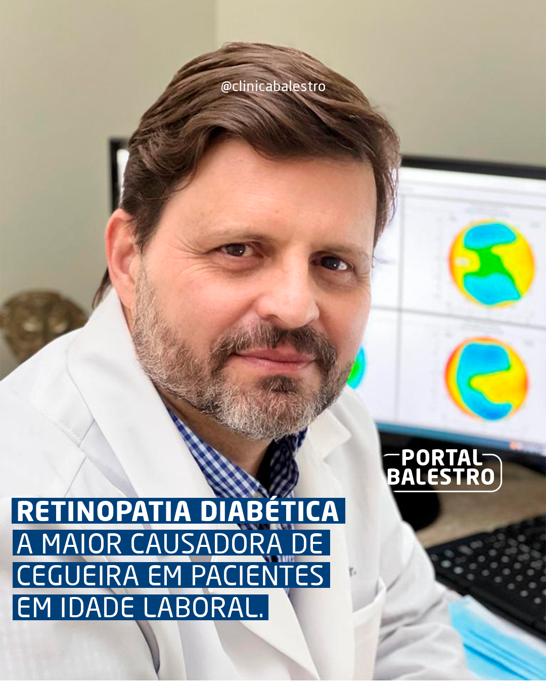 Retinopatia Diabética: a maior causadora de cegueira em pacientes em idade laboral