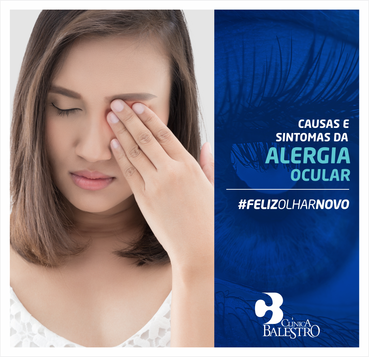 Causas e sintomas da alergia ocular